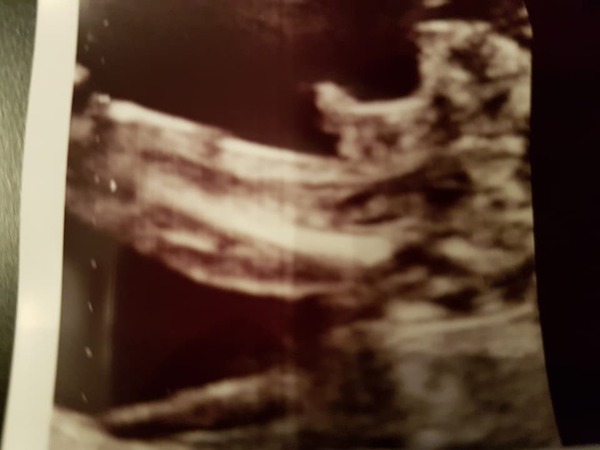 Boy or Girl