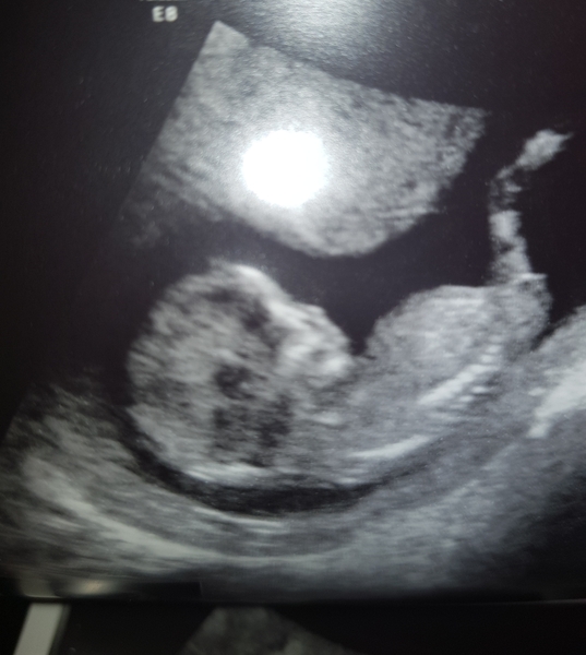 Gender guesses welcome!