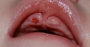 Baby's tooth - help!