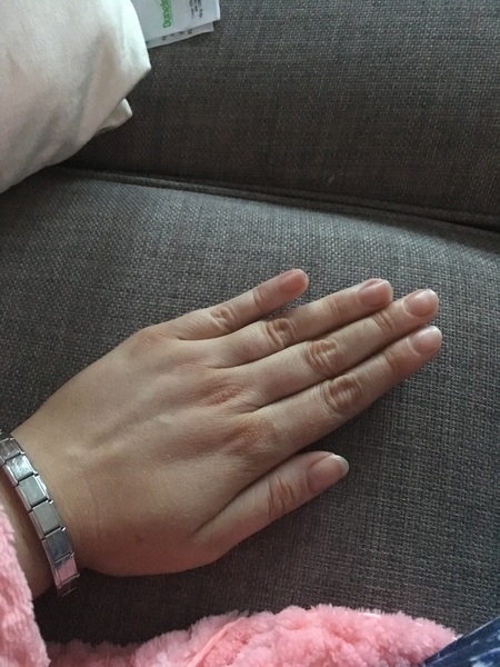 Injured hand