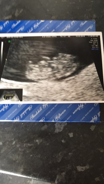 Had a scan today...
