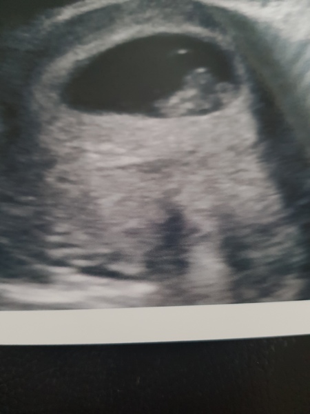 September 2018: #3! Early scans and booking in... it's all getting very real!