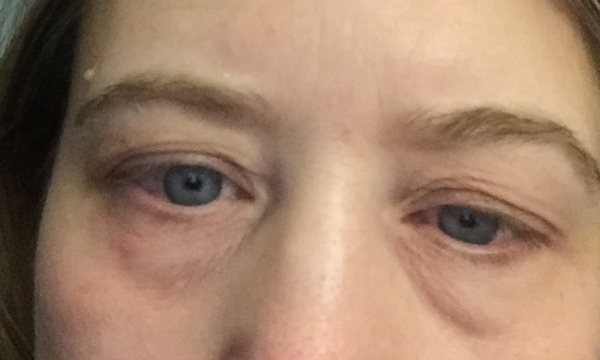 Help me with my eyes! (Pic)
