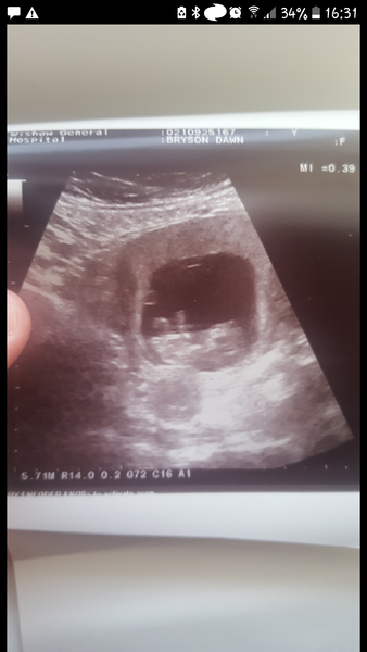 September Babies 2018 #2