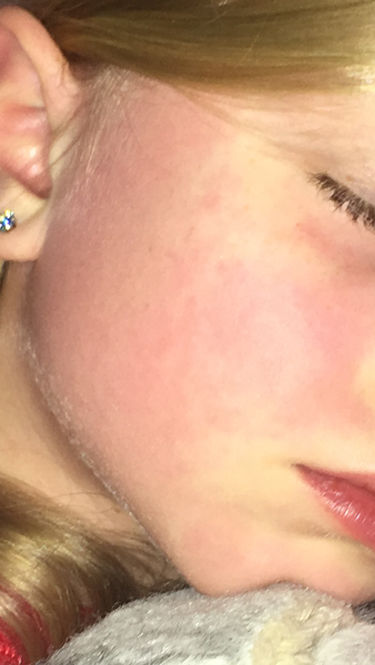 Could these symptoms be connected?!