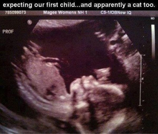 New babies sex
