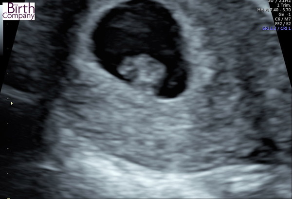 October 2018 baby bus