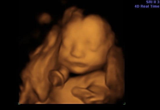 4D scans resemblances
