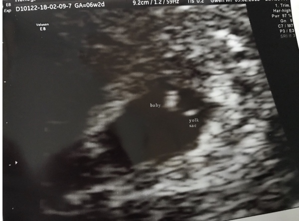 October 2018 baby bus