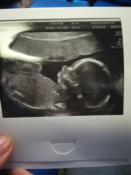 I'm having a Girl.....