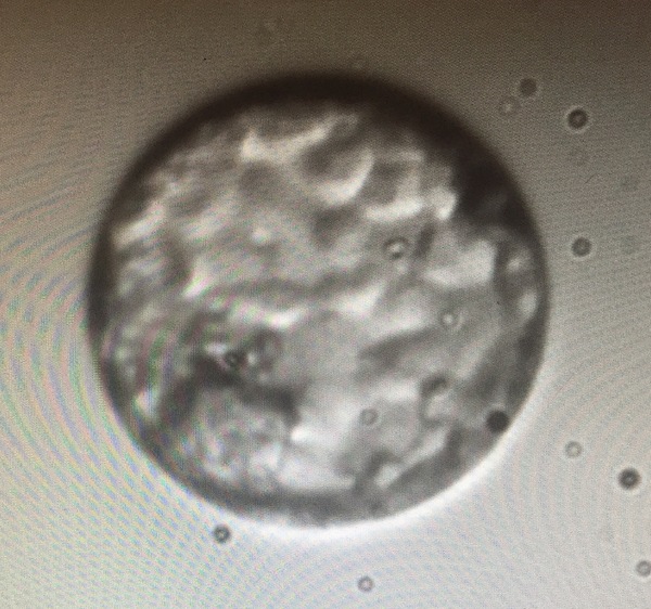 IVF - A supportive group of ladies at various stages of the ivf journey.