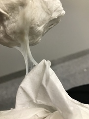 Could this be my plug? (Gross picture)