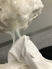 Could this be my plug? (Gross picture)