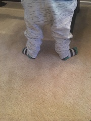 Posting for traffic - my toddler’s feet, this can’t be ok?