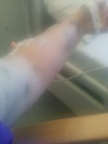 I need advice re making a complaint against a member of A&E staff