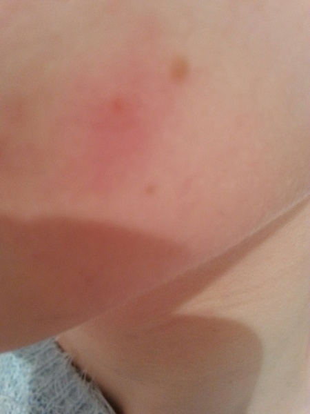 ...to be freaked out I could have bedbugs?