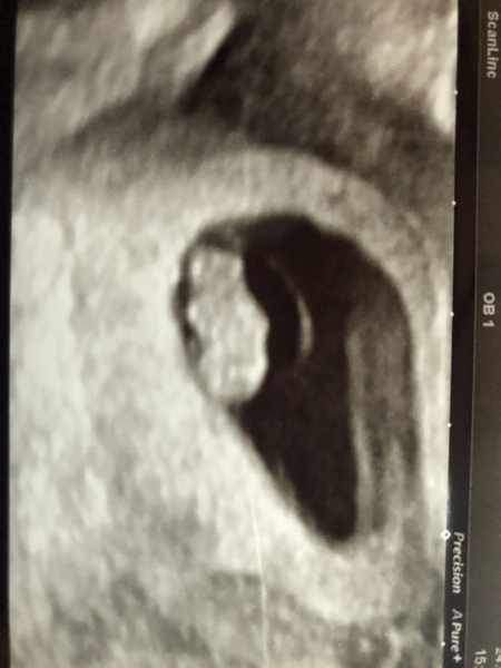 November 2018 #2