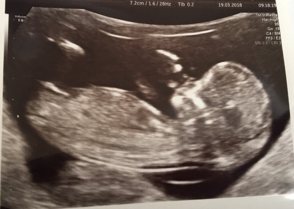 September Babies 2018 #2