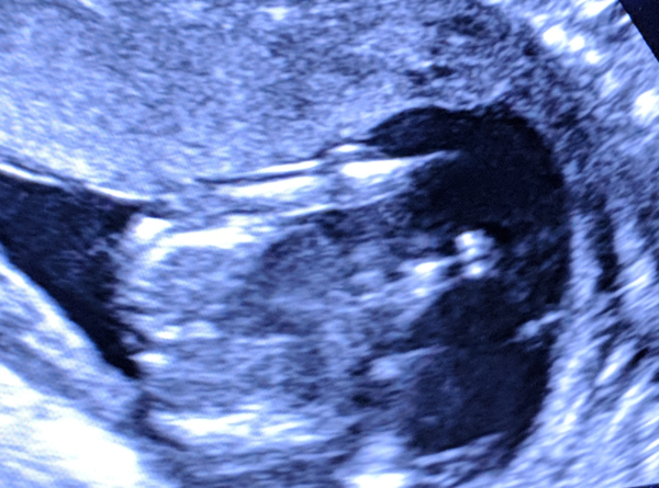 September 2018 Babies - Thread #3
