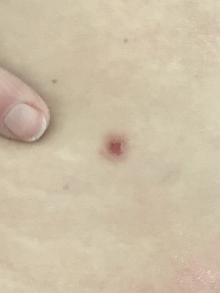 To ho to the doctor with this?