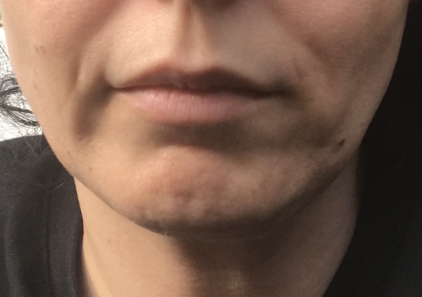 Moustache shadow .. with photo :-(