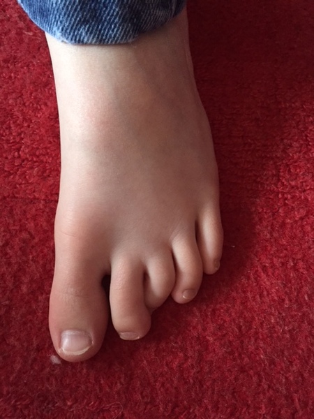 Son's toes