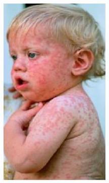 Haven't had vaccinations yet please share experiences