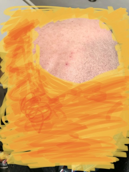 What are these marks on head?