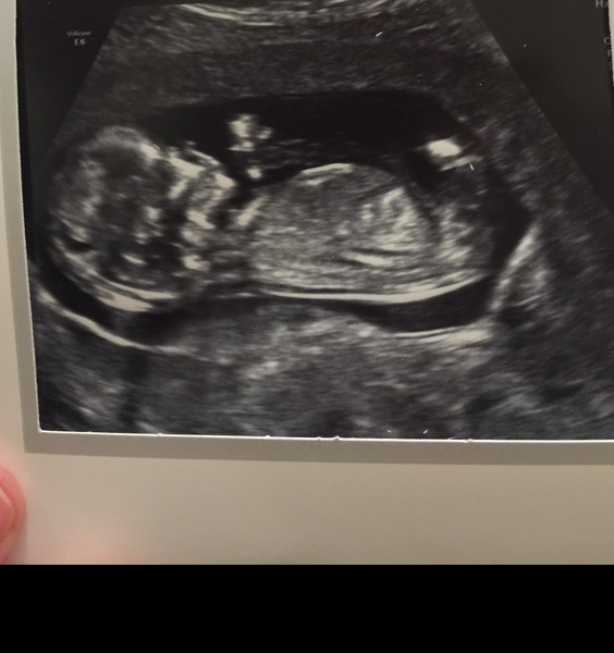 Can anyone guess the gender?