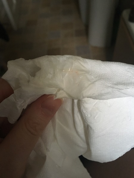 Should I be concerned about this? *pic included*