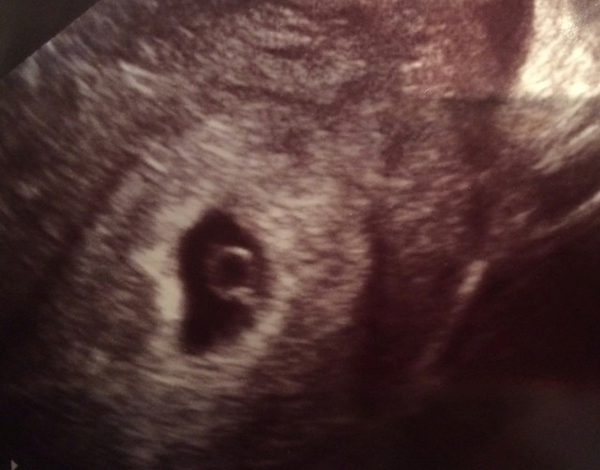 What exactly can you see in a 6 week scan?