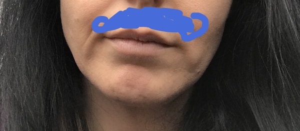 Moustache shadow .. with photo :-(