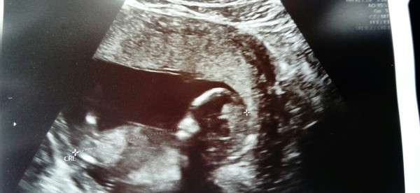 Any guesses boy or girl