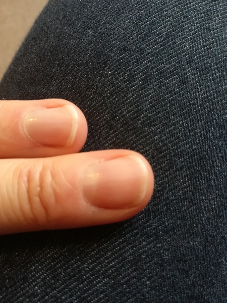 Show me your lovely short nails!