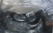 11wks & just don't feel pregnant - fearing the worst :(