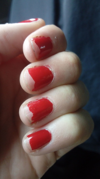 Why does my nail varnish always chip?