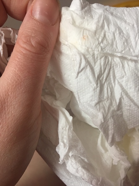 Slight spotting after sexual activity last night *pic attached*