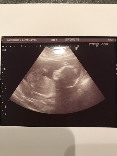 July 2018 babies - part 2 :)