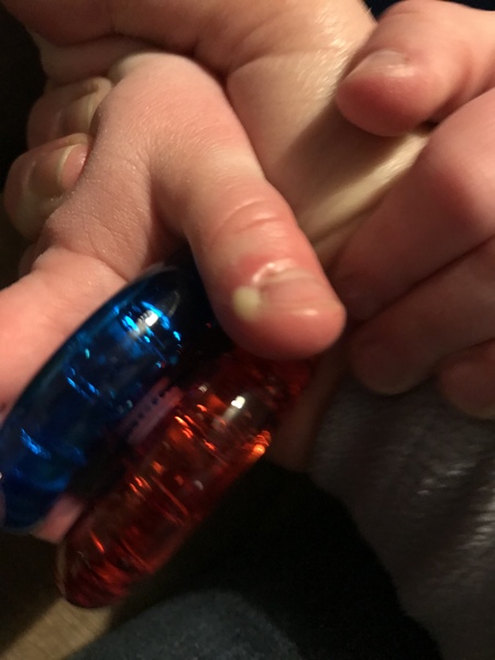 What’s this on DS’s finger?