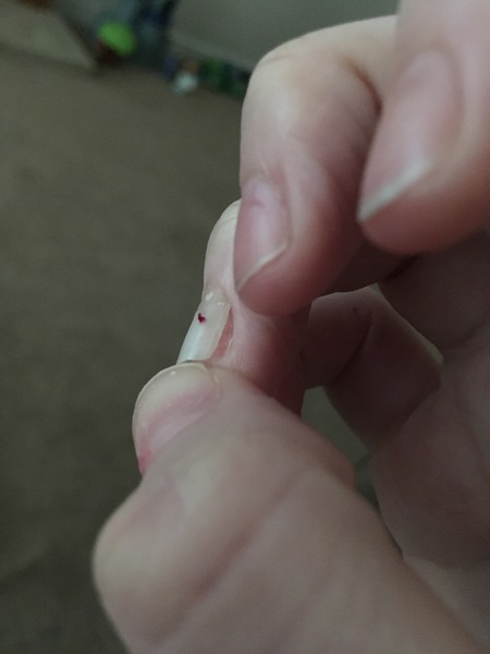 Can I recover damages from a nail salon who ruined my nail permanently?
