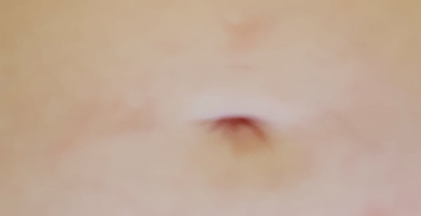 to think my naval is vanishing? (Pregnancy related)