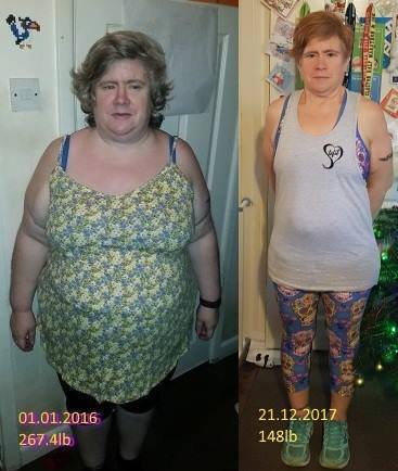 AIBU to think some people just aren’t capable of losing weight and being healthy?