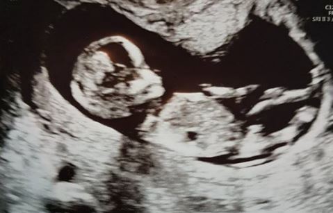 September Babies 2018 #2