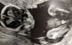 September 2018 Babies - Thread #3