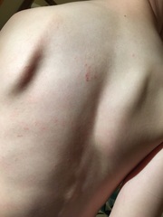 Strange itchy rash