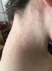 Odd rash (picture) sore throat & feeling unwell