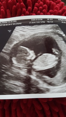 Gender guess