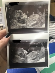 Boy or girl? Loads of pics