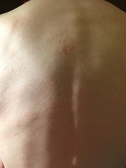 Strange itchy rash