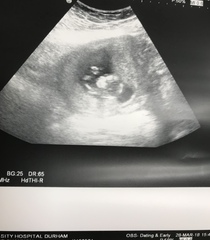 Boy or girl?